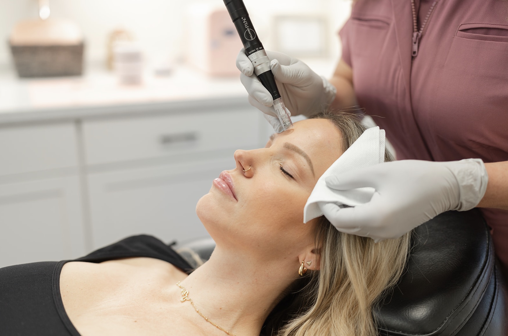 Woman receiving Microneedling treatment.